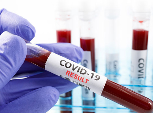 За минулу добу в Україні зафіксували 13531 новий випадок COVID-19