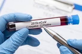 За прошедшие сутки в Украине зафиксировали 6029 новых случаев коронавируса COVID-19