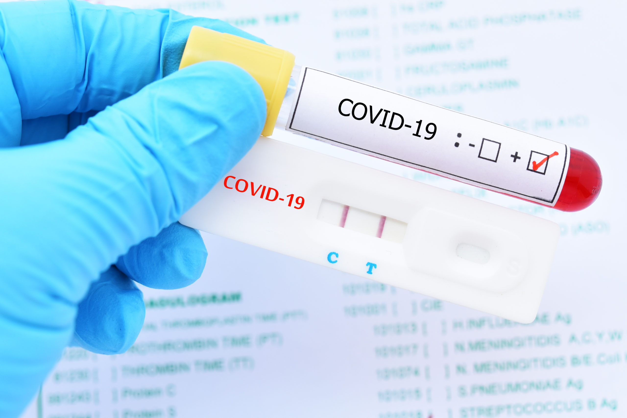За минулу добу в Україні виявили 23 378 нових випадків COVID-19